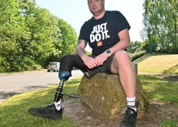 Shaun Rigby, 37, lost his leg below the knee in a tractor accident aged just two and took up cricket as a seven-year-old boy