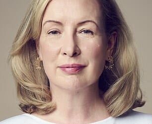 Claudia before the procedure