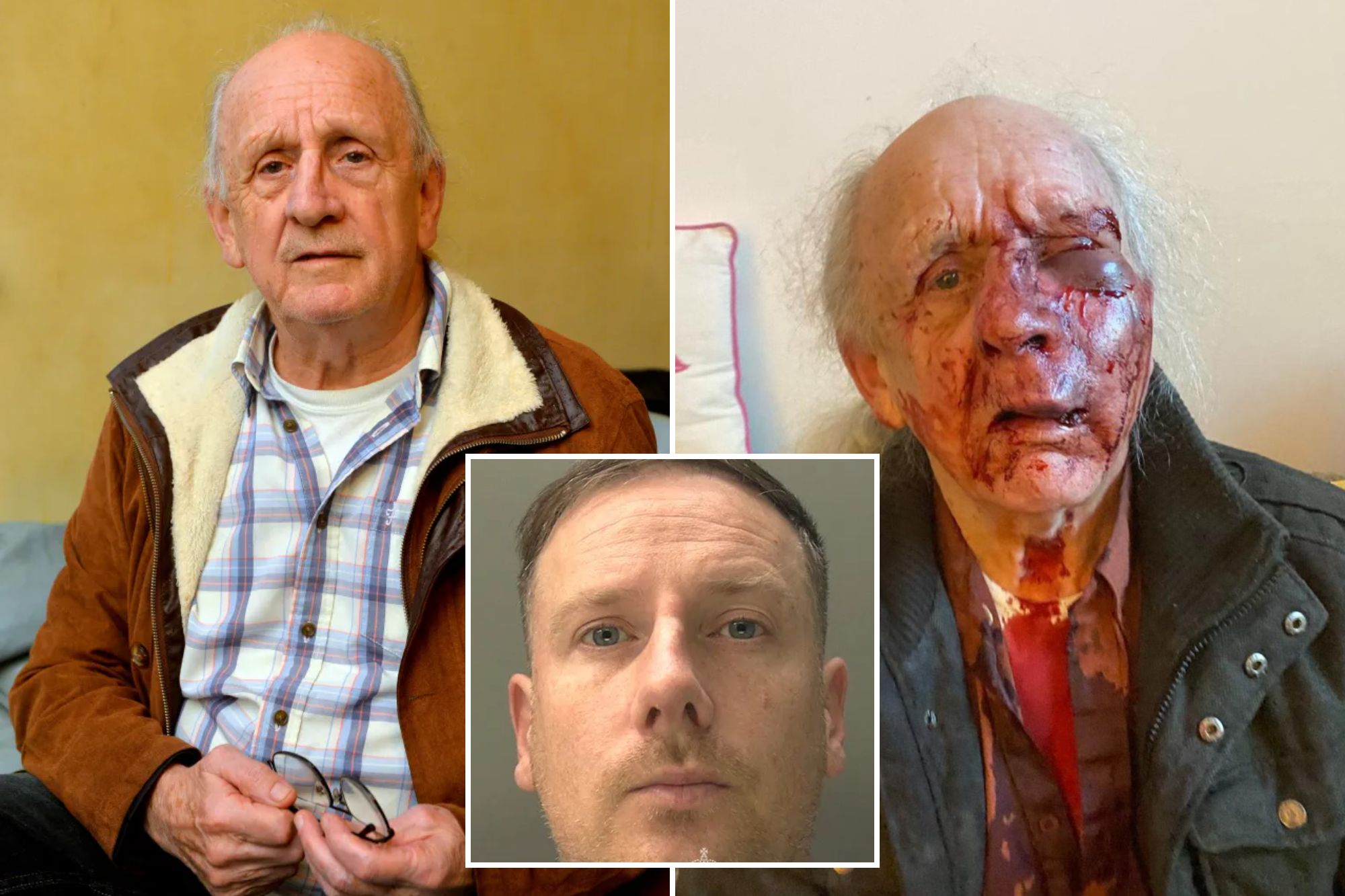 An image collage containing 3 images, Image 1 shows Lyndon Griffiths after recovering from a brutal street attack, Image 2 shows NINTCHDBPICT001037960567, Image 3 shows Mugshot of Ashley Morris