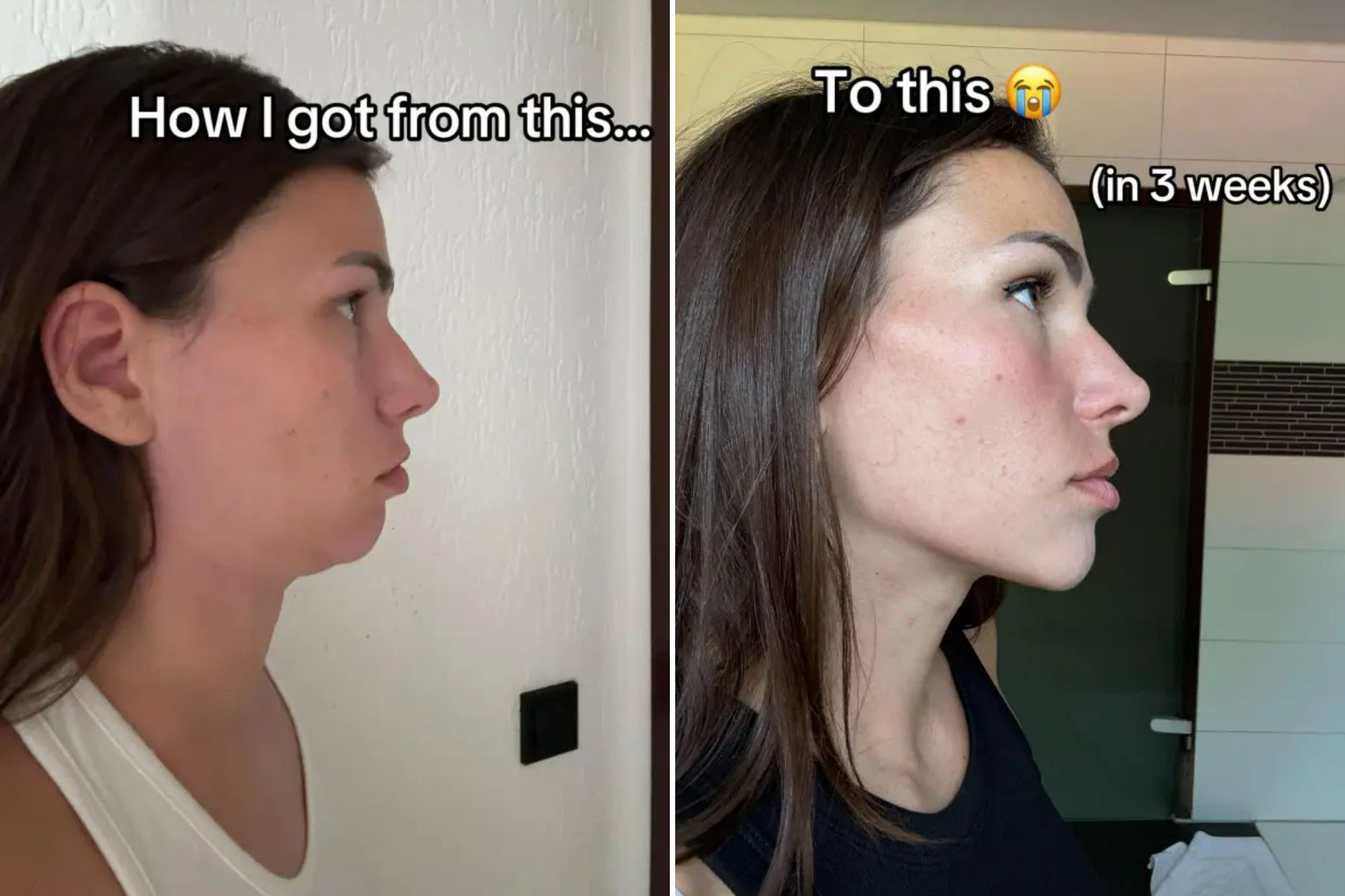 An image collage containing 2 images, Image 1 shows A woman's profile showing a double chin, with the text "How I got from this...", Image 2 shows Profile view of a woman with long dark hair and clear skin, wearing a black top. Text overlay reads "To this" with a crying emoji and "(in 3 weeks)"