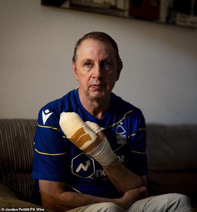 Huntingdon stabbing victim Stephen Crean at his home in southwest London on Monday