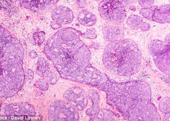 Strictly's Amy Dowden shares health update after second mastectomy as she tunes into Celebrity Traitors from her hospital bed