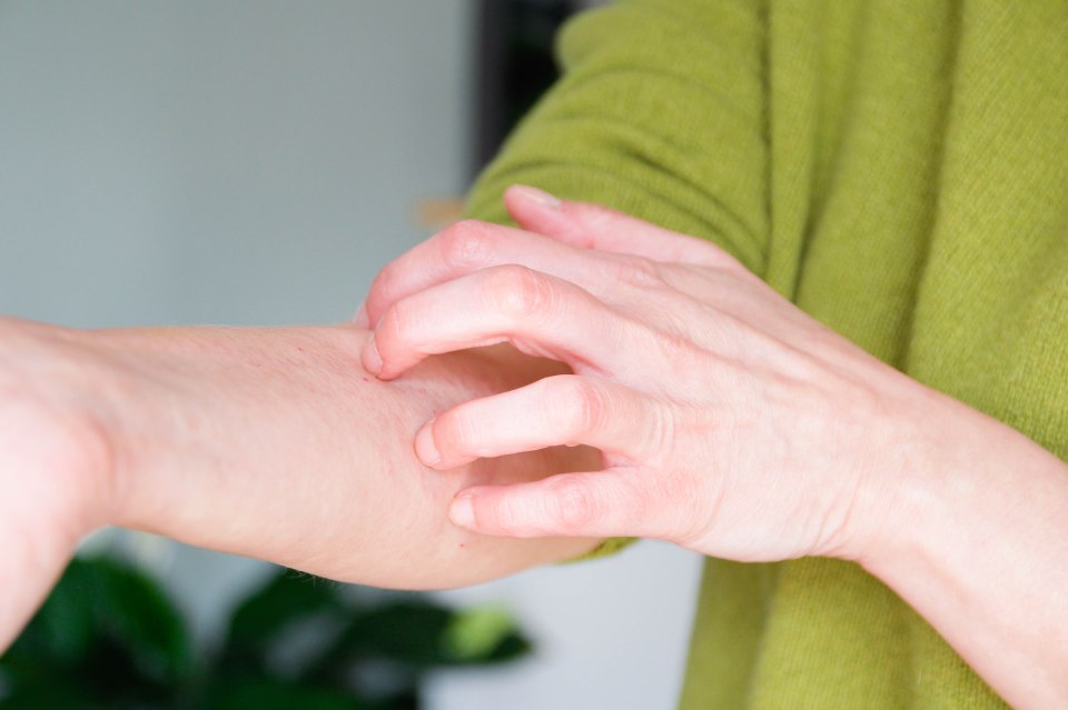 Person scratching their arm due to an itch or rash.
