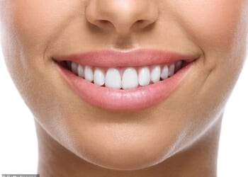 Surveys show about 40 per cent of those under 35 in the UK regularly have their teeth whitened, and the industry is currently worth some £40 million a year