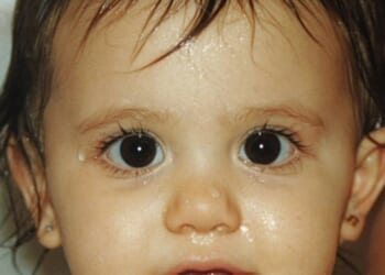 After her time on Nickelodeon, her singing career went on to explode as she has garnered an impressive six number one albums, two Grammy awards and one Oscar nomination