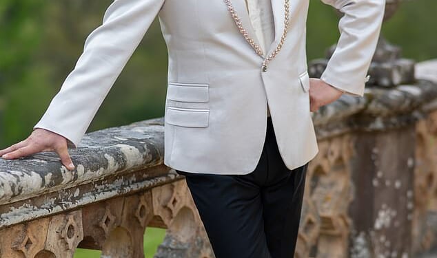 Alan Carr has often spoken about his tendency to sweat to excess – medically known as hyperhidrosis