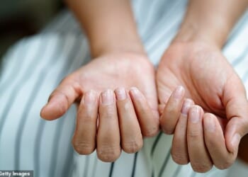 This is what your brittle, yellow or peeling nails really mean for your health - and the tell-tale sign something sinister is going on, revealed by our top expert