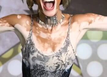 Winnie Harlow is facing fierce backlash after recreating one of the most vulnerable chapters of Whitney Houston's life