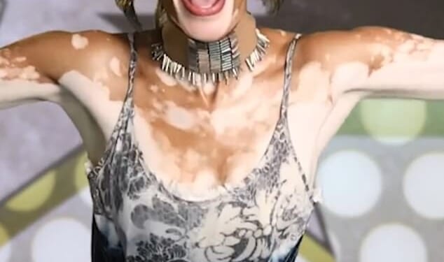 Winnie Harlow is facing fierce backlash after recreating one of the most vulnerable chapters of Whitney Houston's life