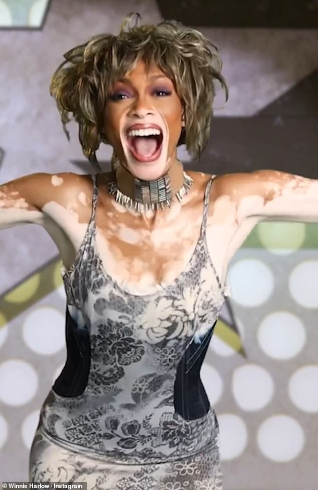 Winnie Harlow is facing fierce backlash after recreating one of the most vulnerable chapters of Whitney Houston's life