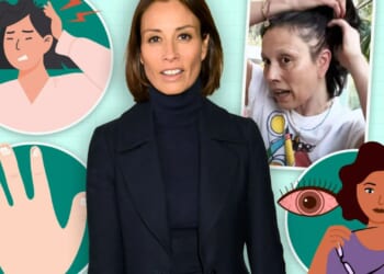 The terrifyingly subtle signs of alopecia that strike BEFORE hair loss