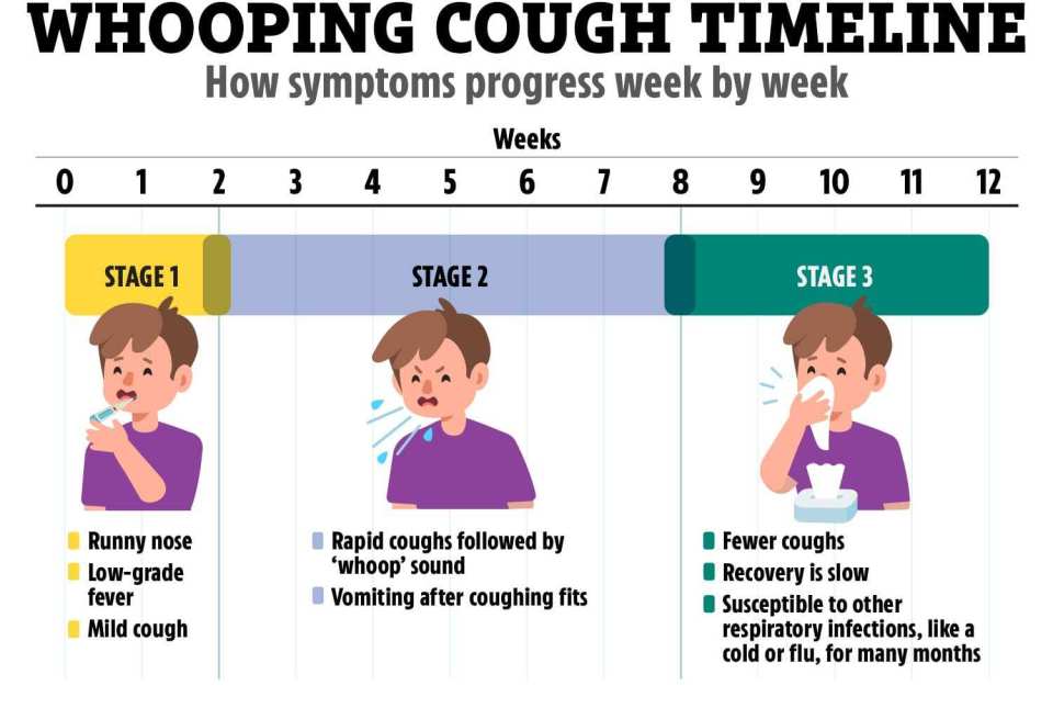 whooping cough timeline showing how symptoms progress week by week