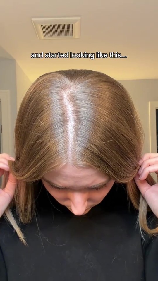 A person with their head bent forward, showing the top of their head and hair parted down the middle, with text that reads "and started looking like this..."