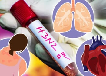 How the 'superflu' surging can kill you and the 6 easy-to-miss signs it's turning deadly