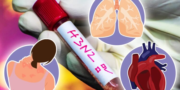 How the 'superflu' surging can kill you and the 6 easy-to-miss signs it's turning deadly