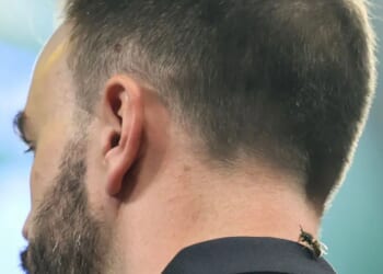 Why are there wasps at Ally Pally during the World Darts Championship?