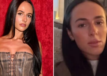 Love Island's Lauren Wood reveals what cosmetic surgery she's had as she opens up about feeling 'insecure' before op