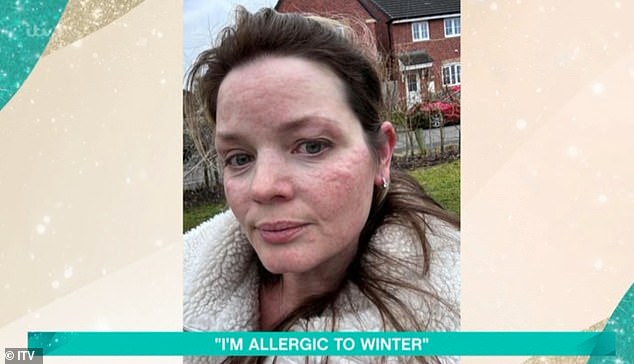 Kirsten noticed the change back in February while on the school run - but she thought it was just caused by stress because she was heading back to work after maternity