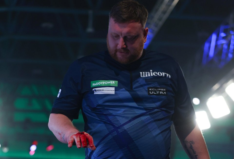 A darts player with a bloody hand looking down during the Paddy Power World Darts Championship.