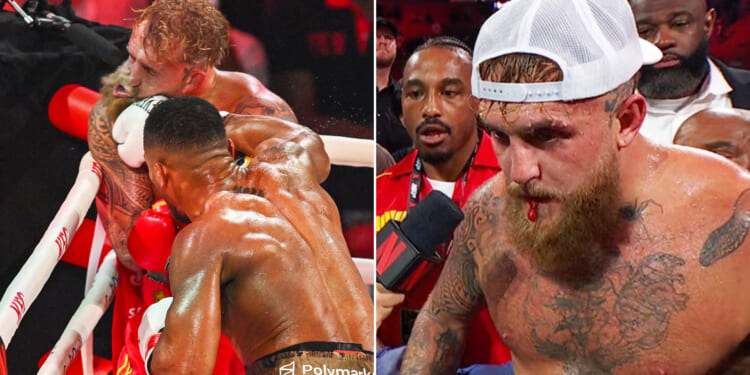 Jake Paul drives HIMSELF to hospital after YouTuber suffers broken jaw in horror KO defeat to Anthony Joshua