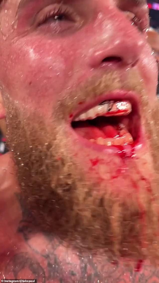 'The Problem Child' also posted a graphic video showing the damage he had sustained