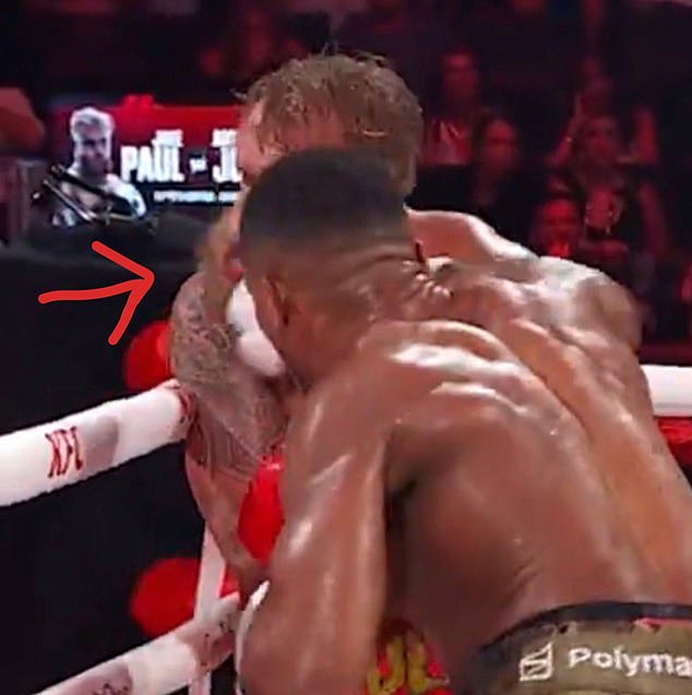 Paul posted this image, showing the moment of impact that shattered his jaw