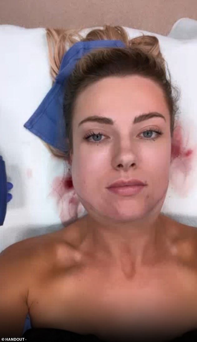 Aspen believed that she had a 'double chin' that she did not have because she used social media filters (pictured during surgery)