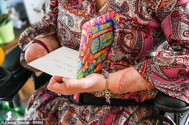 Kim has now become naturally left-handed ¿ despite her right side being dominant before