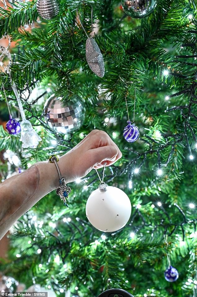 Earlier this year, Kim was received the gift of a working left hand after being on a UK waiting list for a double hand transplant