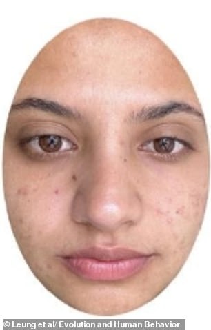 Picture F: Compared to the previous photo, do you think this person appears more sick here?