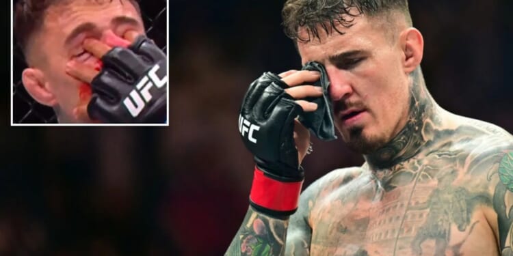 Tom Aspinall confirms eye surgery in grim UFC medical update after being diagnosed with rare condition after double poke