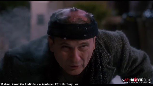 Pesci has since revealed he did sustain serious burns due to this stunt