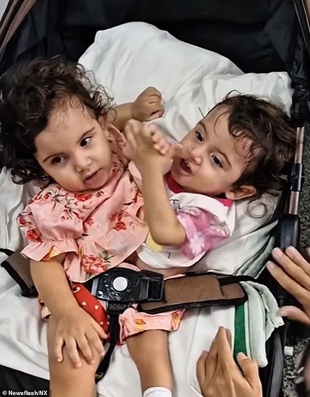 Aruna's twin sister Kiraz (left) died days after the complex procedure to separate the pair in May