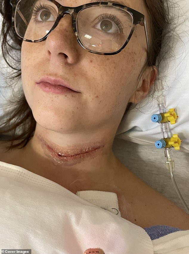 Christensen, pictured here after surgery, now has to take hormone therapy to replace hormone levels lost from her thyroidectomy