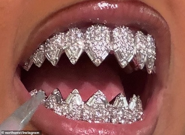 The 12-year-old showed off a new custom-made set of grillz by celebrity jeweler Johnny Dang