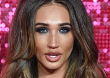 Megan McKenna reveals real reason she ditched THAT 'humungous' pout & says she had no choice but to have a lip 'rebrand'