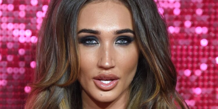 Megan McKenna reveals real reason she ditched THAT 'humungous' pout & says she had no choice but to have a lip 'rebrand'