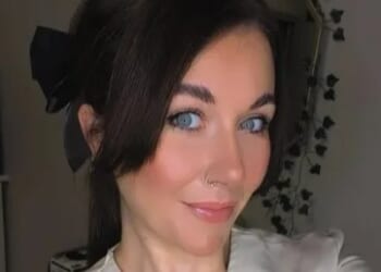 'Agonising' skin condition left mum-of-two looking like she had 'permanent sunburn' with bumps over her face