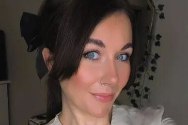 'Agonising' skin condition left mum-of-two looking like she had 'permanent sunburn' with bumps over her face