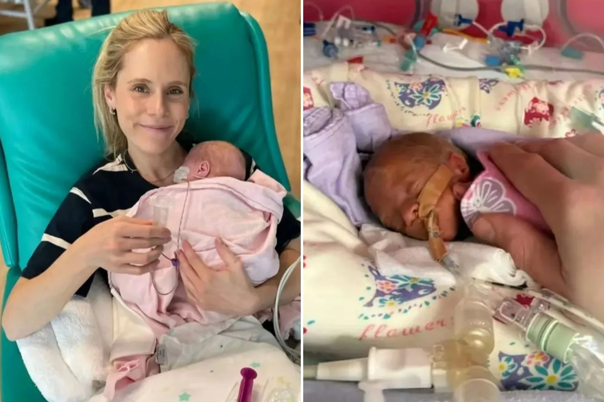 An image collage containing 2 images, Image 1 shows Mum told to choose one twin to live celebrates first Christmas at home with BOTH fighters who weigh 1lb each, Image 2 shows Mum told to choose one twin to live celebrates first Christmas at home with BOTH fighters who weigh 1lb each