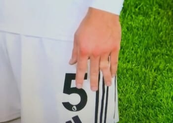 Joachim Andersen appeared to dislocate a finger during Fulham's tie with Nottingham Forest