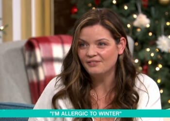 A This Morning guest (pictured) opened up about her allergic reaction to the cold - which sees her body break out in hives
