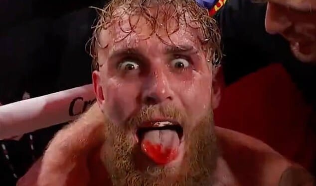 Jake Paul's jaw was broken by Anthony Joshua in their fight in Miami on Friday night