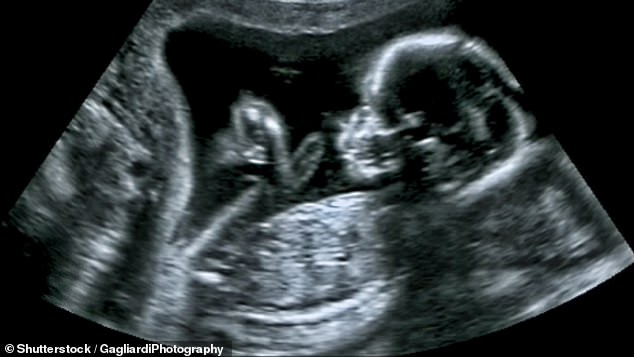 By saying on its website that the ‘law is silent on the matter’ of sex-selective abortions, the British Pregnancy Advisory Service is gaslighting vulnerable women who seek its services