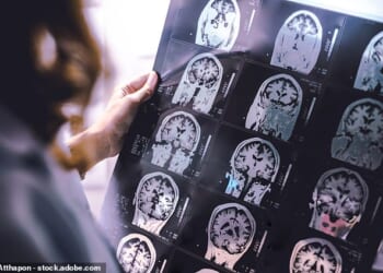 British researchers say a cure for Alzheimer'sdisease could one day be possible, with experts suggesting truly life-changing treatments may emerge within the next five to ten years