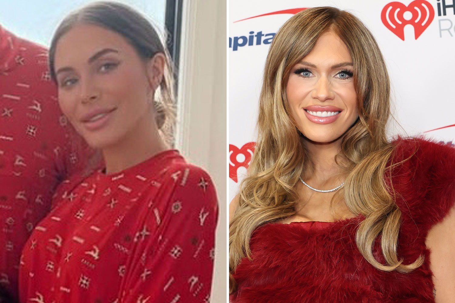 Collage of a woman before and after cosmetic surgery.