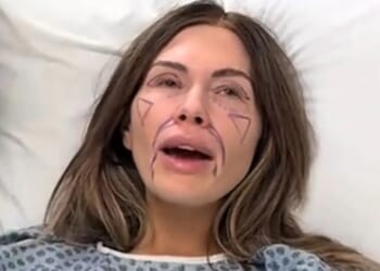 Mormon Wives’ Jessi Ngatikaura debuts very different new face after undergoing plastic surgery procedure