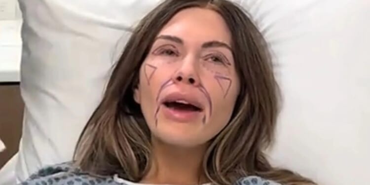 Mormon Wives’ Jessi Ngatikaura debuts very different new face after undergoing plastic surgery procedure