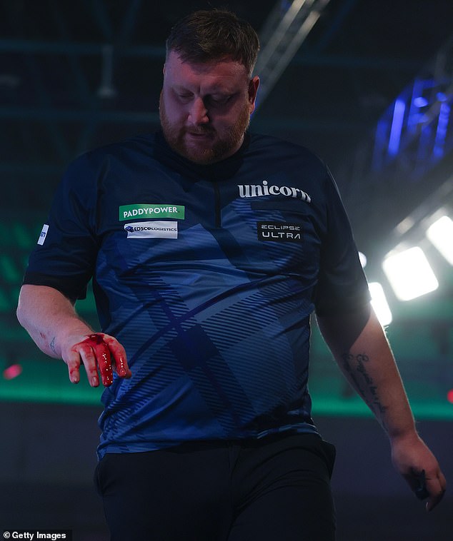 The incident left Menzies with a blood soaked hand but he later revealed the reason for it