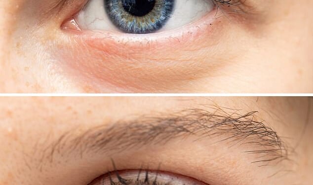 A simple test could reveal if you have a little-known condition that sees people unable to visualise imagery in their mind